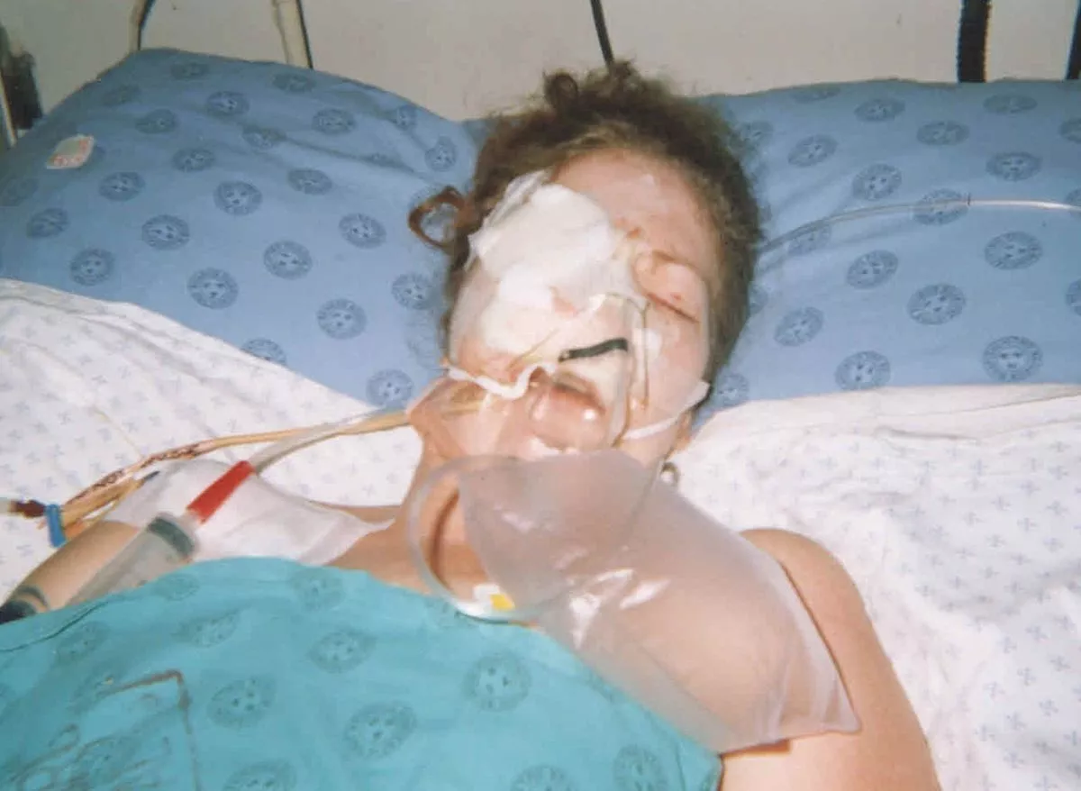 The woman in hospital after the car crash