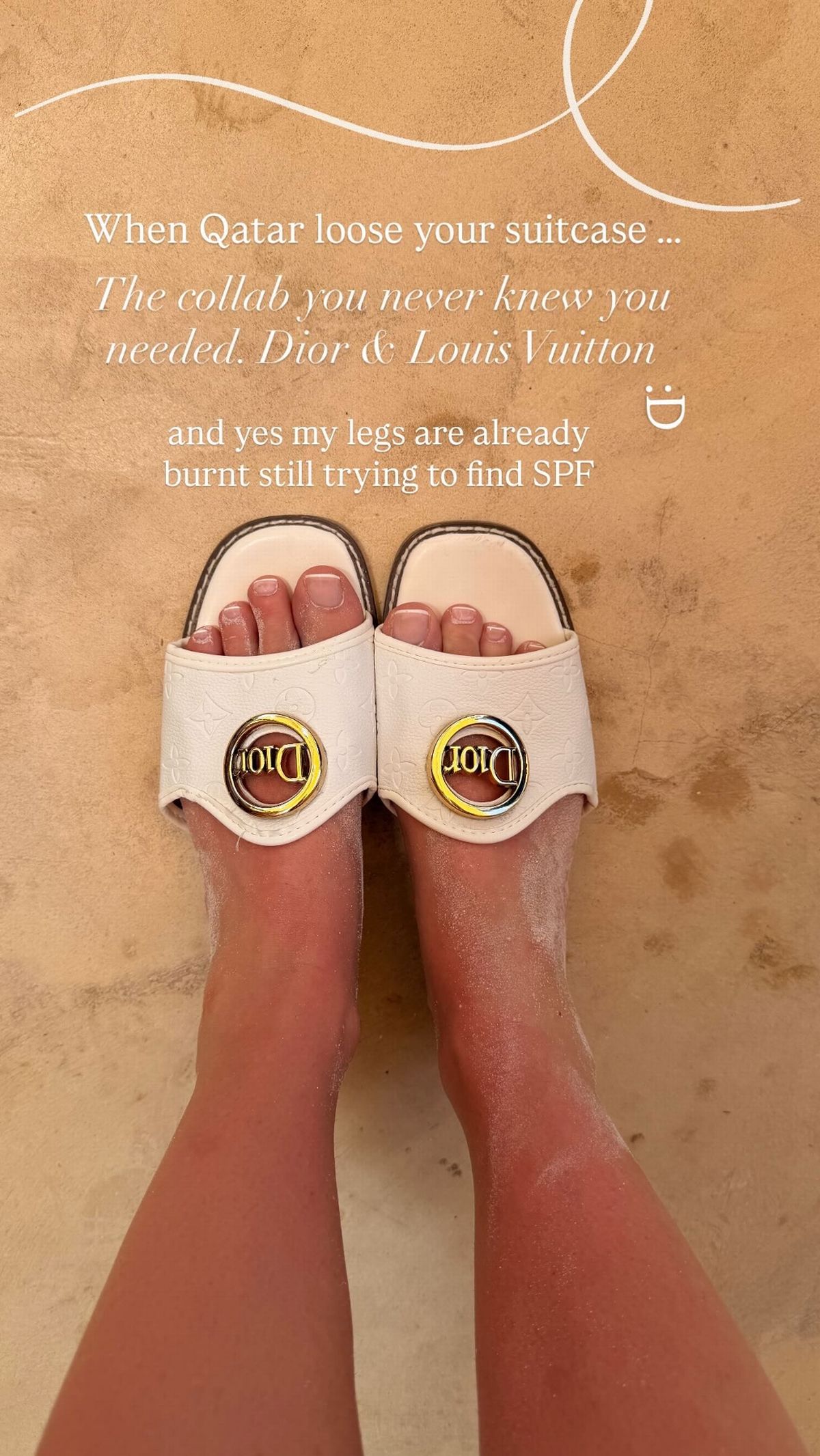 Lydia said the family didn't even have SPF in 28-degree heat 