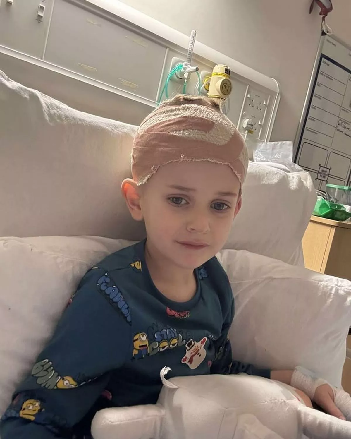 Rory needed surgery on a lesion on his head