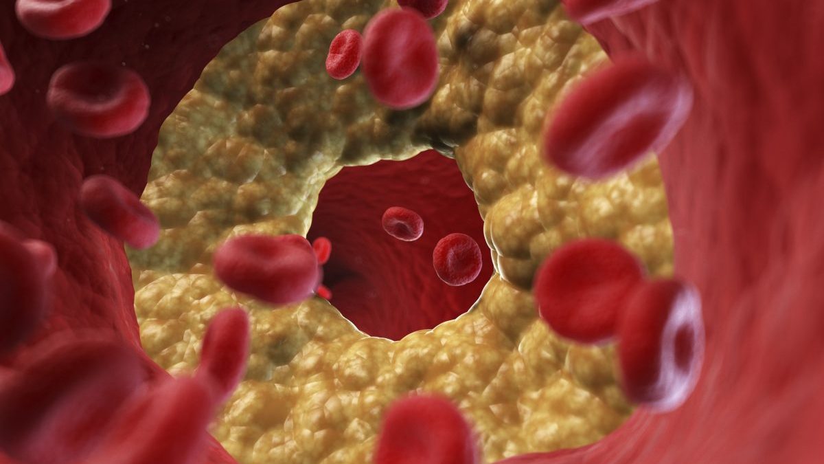 Think you know about good and bad cholesterol? Read this first