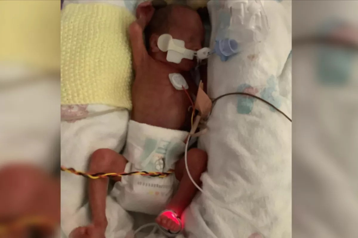 Rory Caulton was just 18 days old when he died at Nottingham City Hospital