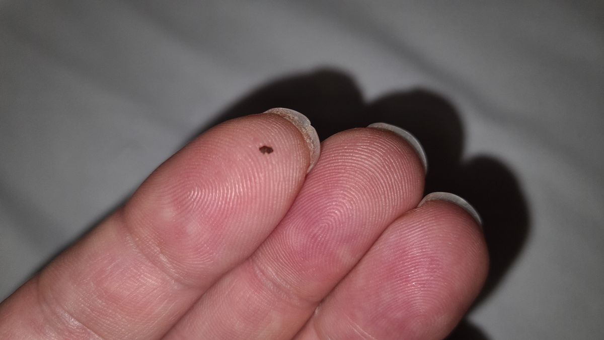 A flea which was photographed by James Alexander after he found them in his hotel room bed