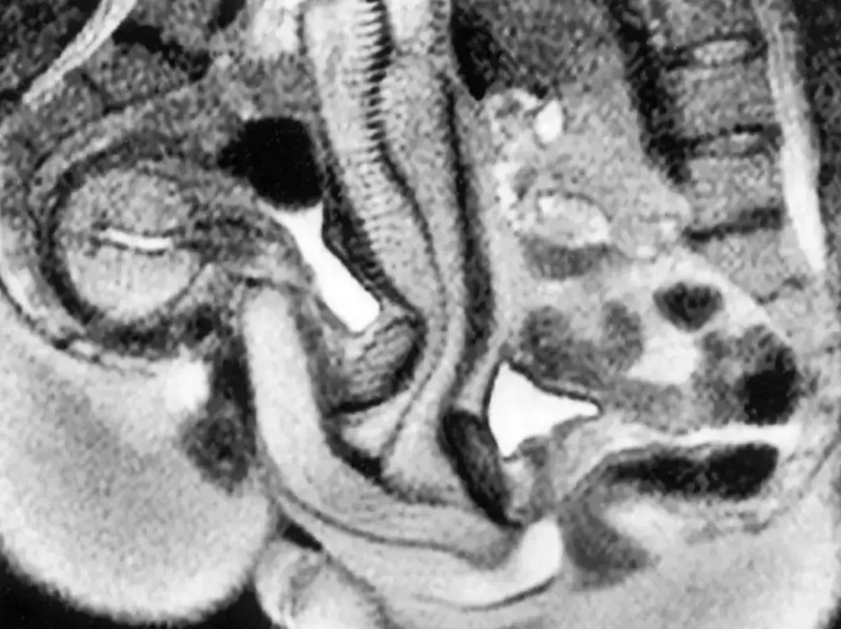 The MRI scan gave scientists a real insight into how bodies react during sex