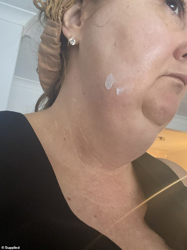 One day in 2023, Briar started coughing up blood. Doctors found a lump at the back of her throat which was cancerous