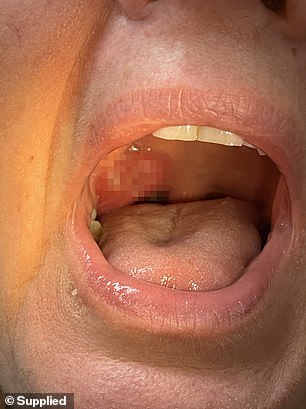 Briar was diagnosed at 58