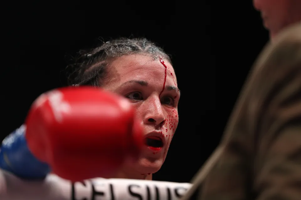 SAN JUAN, PUERTO RICO - JANUARY 03: Stephanie Han is checked by a ringside physician after suffering a cut from an accidental head butt against Holly Holm in the WBA World Lightweight Championship bout at Coliseo Roberto Clemente on January 03, 2026 in San Juan, Puerto Rico. (Photo by Ricardo Arduengo/Getty Images)