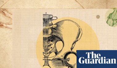 Do the tiny, boring exercises: how to really look after your hips | Health & wellbeing