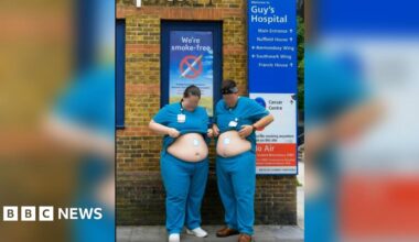 A screen grab of a promotional video showing two doctors in scrubs, outside Guy's hospital placing weight loss patches on their stomachs