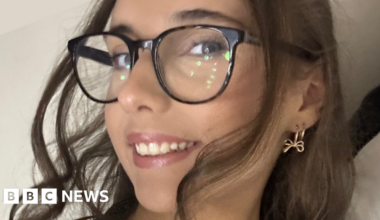 Abergele teenager diagnosed with rare allergy to cold temperatures