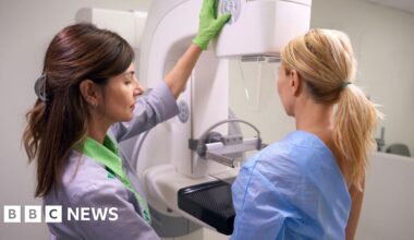 NHS cancer gene database to allow families to check risk