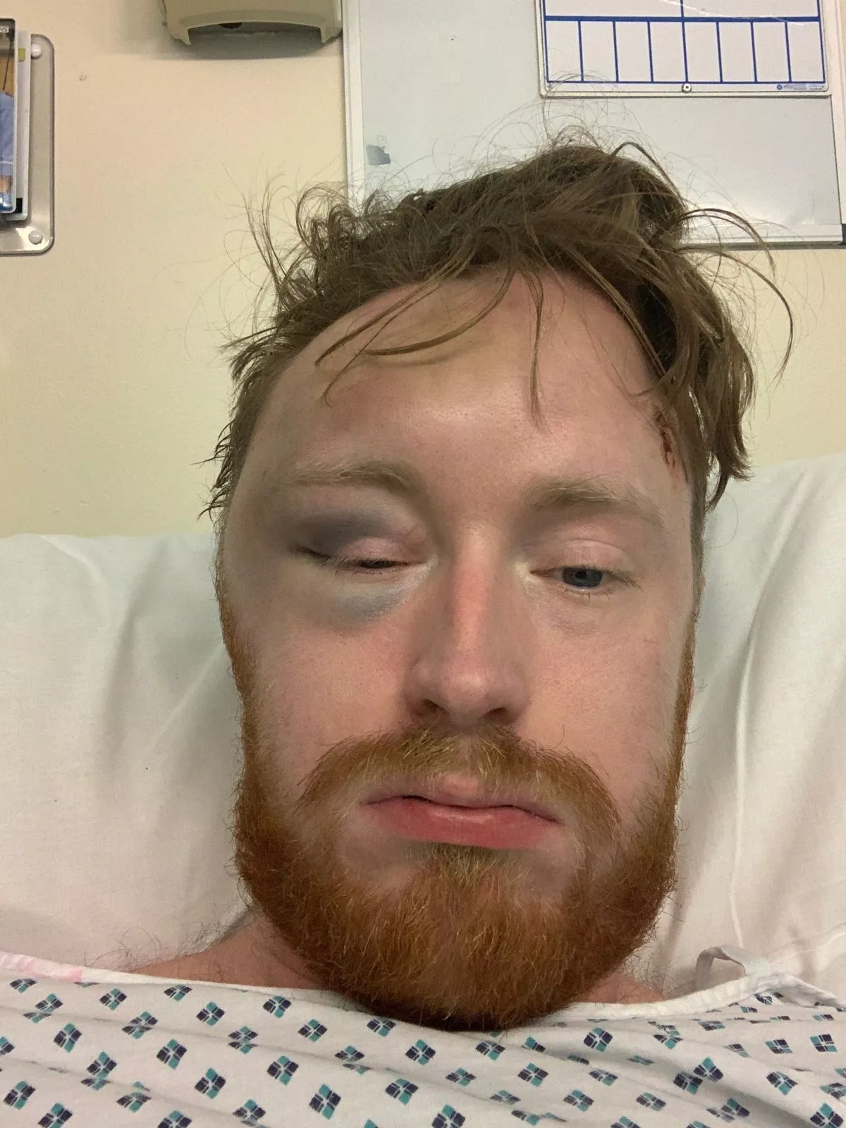 Andi pictured in a hospital bed.