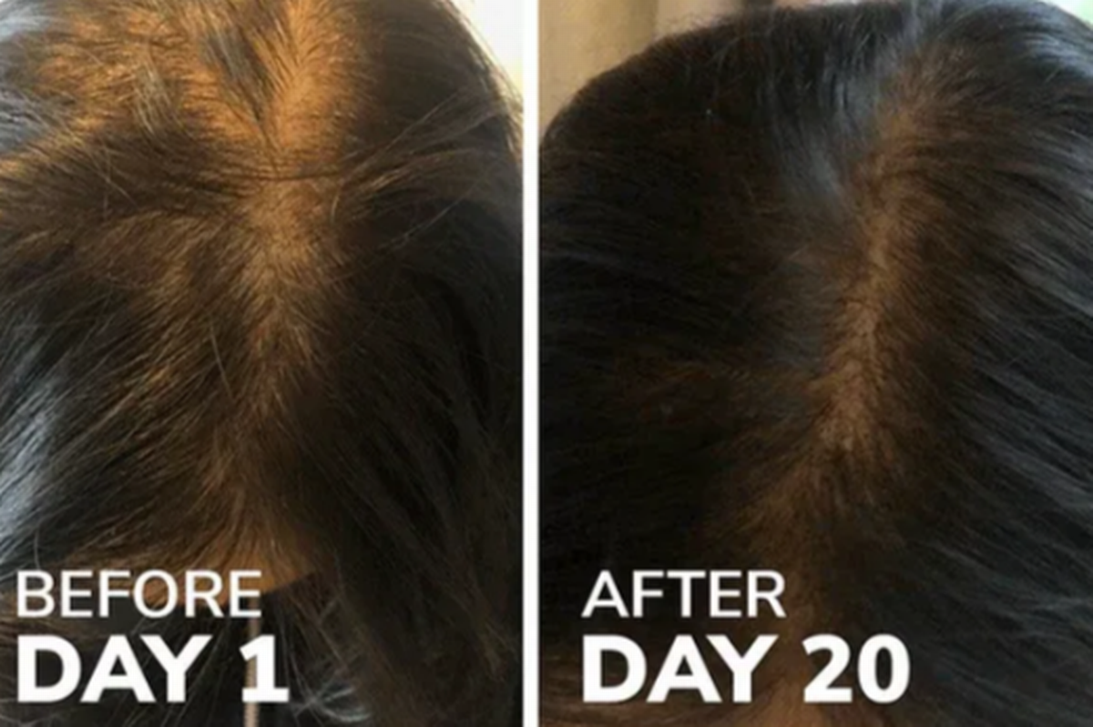 Before and after results on hair using the Reverse Life collagen supplement