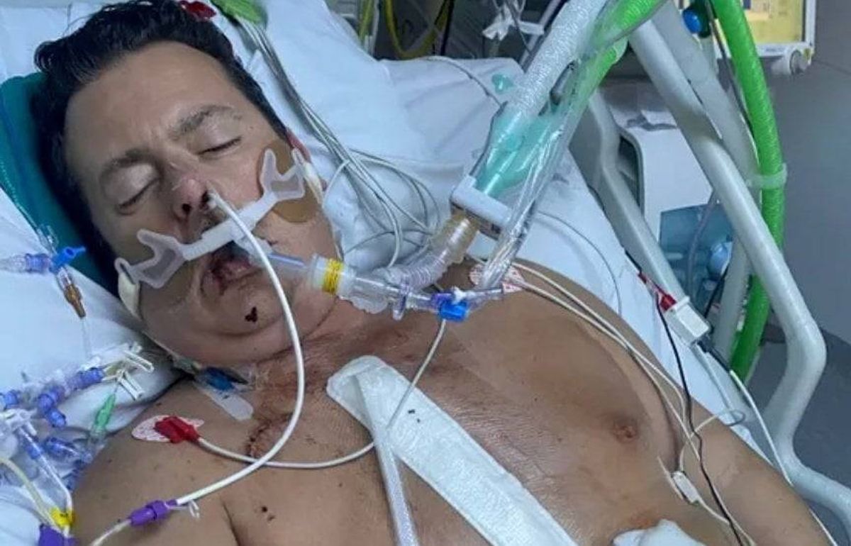 An individual, possibly a patient, lies on a hospital bed with multiple medical devices attached, including a breathing tube and various monitoring wires connected to their chest. The patient appears to be resting with their eyes closed.