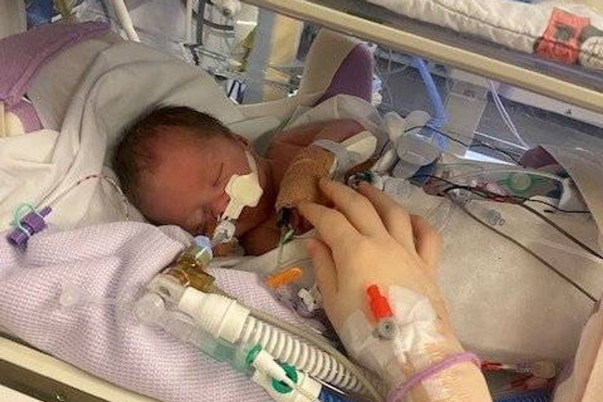 Sonny Taylor was delivered in a poor condition via emergency caesarean