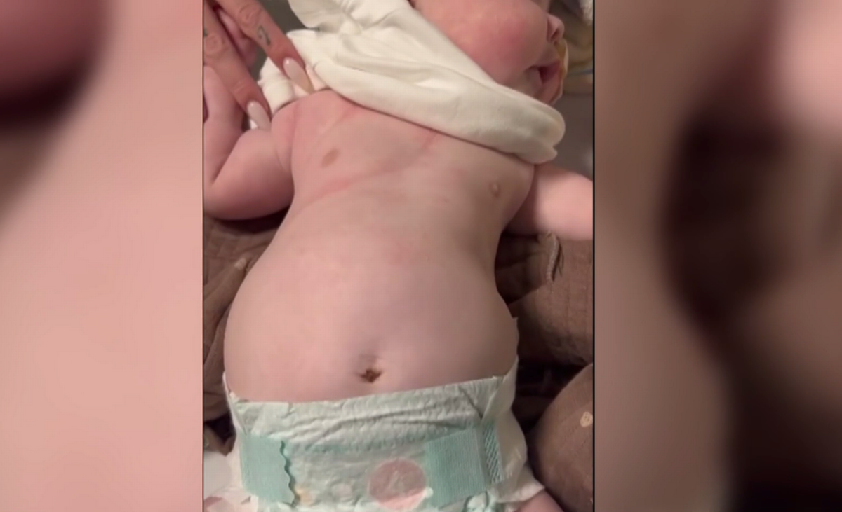 Jesy shared a new video of her twins' worrying breathing on This Morning