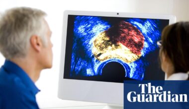 Prostate cancer is most commonly diagnosed cancer across UK, study finds | Cancer