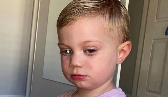 Raye with the 'white glow' in her eye