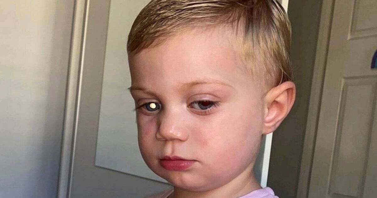 Mum spots sign in daughter's eye and 'falls to floor' at diagnosis