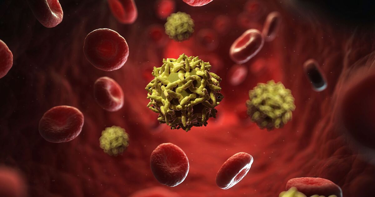 Horror outbreak of ‘yellow jack’ disease leaves 70 dead | World | News