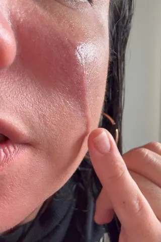 Daniela Mullins Daniela Mullins' scar