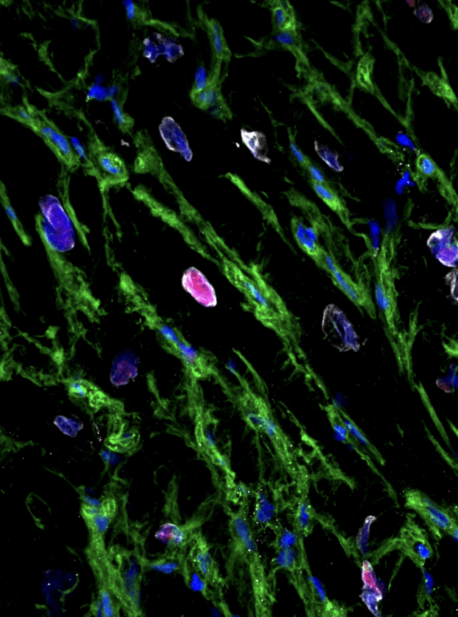 Human Heart Tissue Can Regenerate After a Heart Attack, New Study Shows