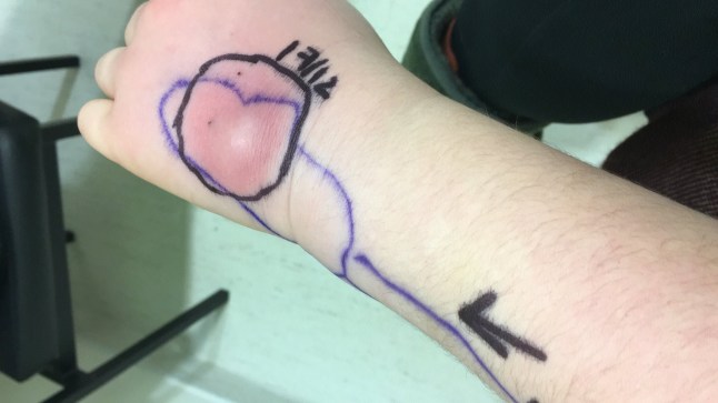 Amy Pohl - I was diagnosed with the 'suicide disease' in my 20s - now, I wouldn?t change a thing