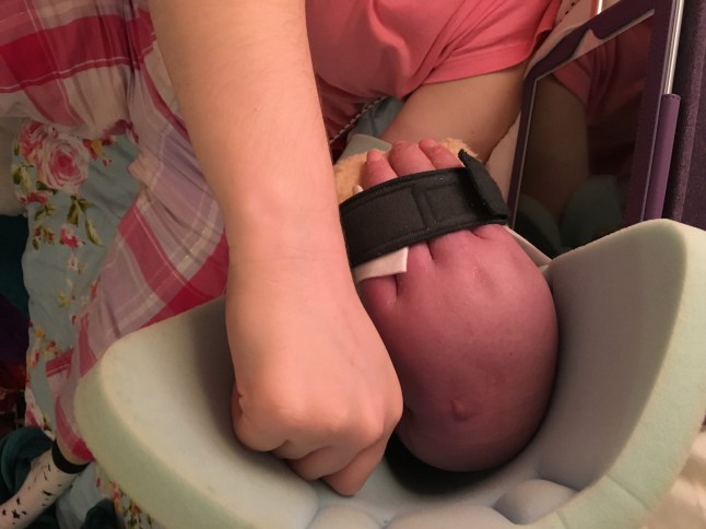 Amy Pohl - I was diagnosed with the 'suicide disease' in my 20s - now, I wouldn?t change a thing