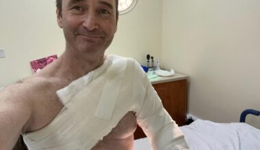 I thought I just had the flu — but a deadly bug was eating me alive