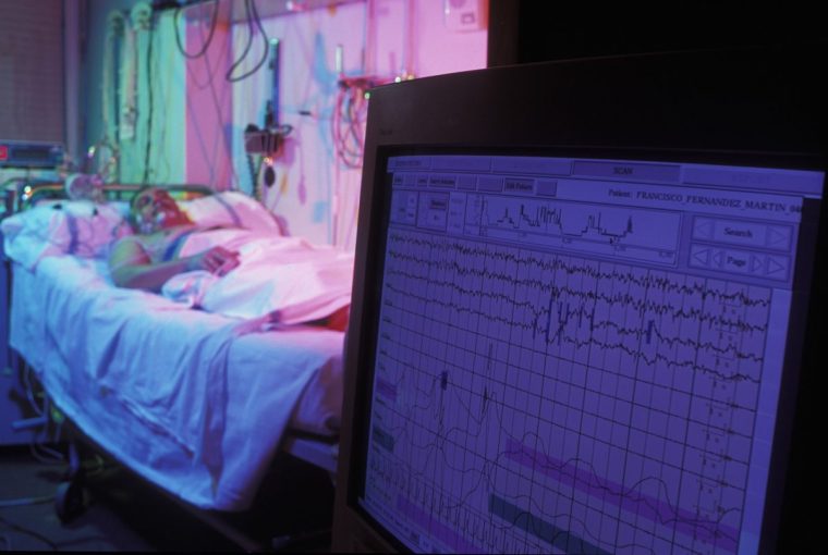 Sleep unit: Sleep disorders medicine is concerned with the diagnosis and treatment of patients with disorders of sleep. (Photo by Luis Davilla/Cover/Getty Images)