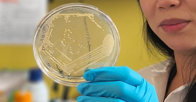 Study helps explain rare condition that causes the body to produce its own alcohol Picture: UC San Diego Health Sciences