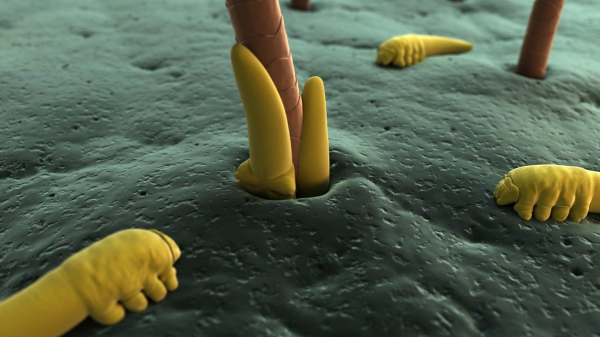 Why dry eyes and skin problems might have an overlooked (and revolting) cause