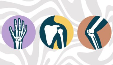 What Happens to Your Bones When You Take Calcium