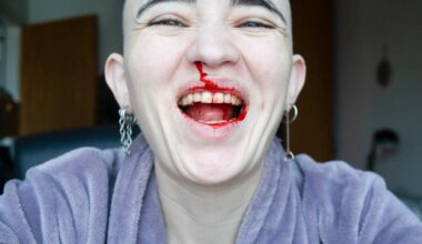 A close-up, joyful portrait of a person with a shaved head laughing broadly, with red liquid resembling blood smeared across their nose, lips, and teeth.
