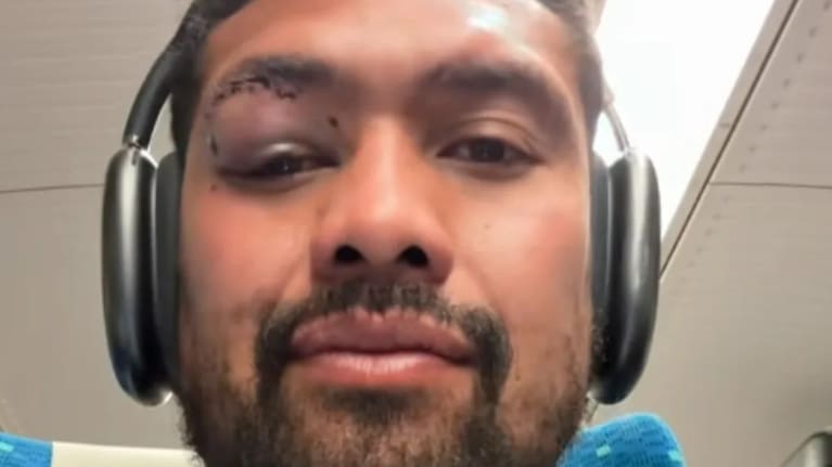 Ardie Savea's black eye, suffered while playing for Kobe Steelers recently.