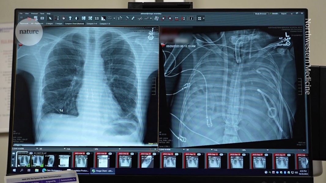 artificial organ kept man alive until transplant