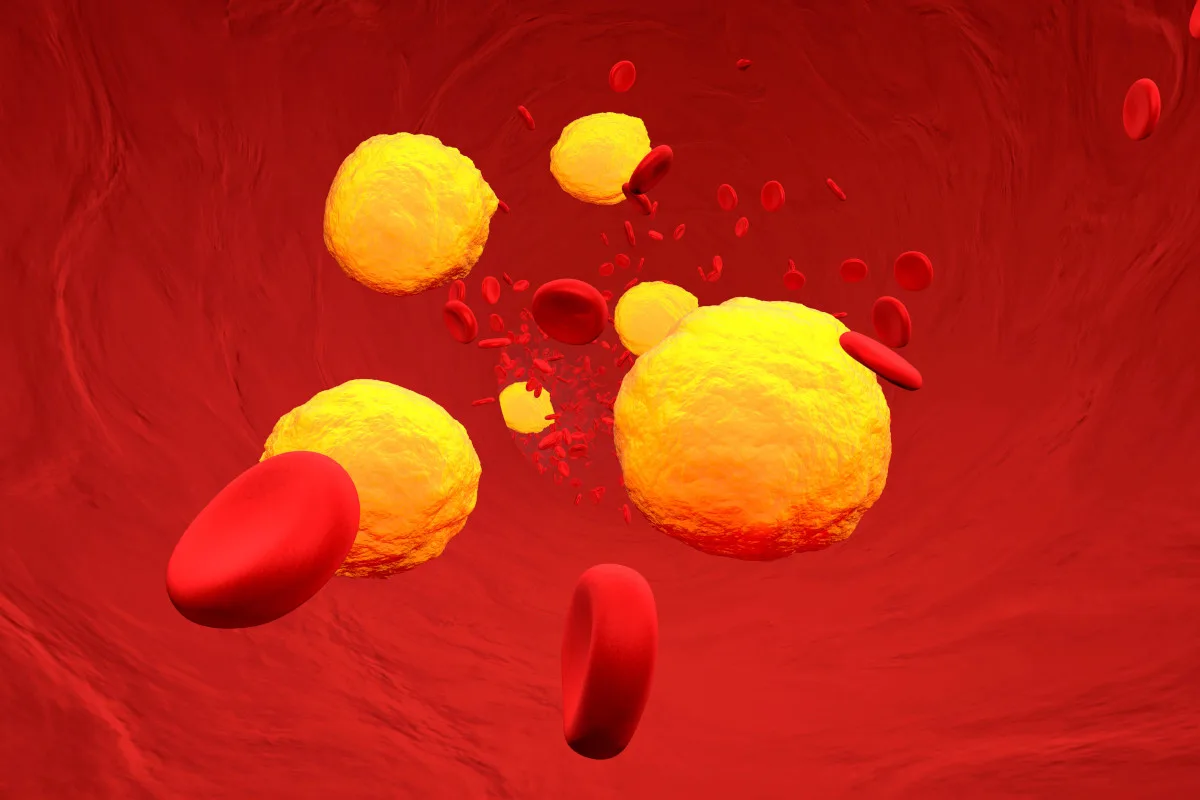 Illustration of cholesterol in bloodstream.