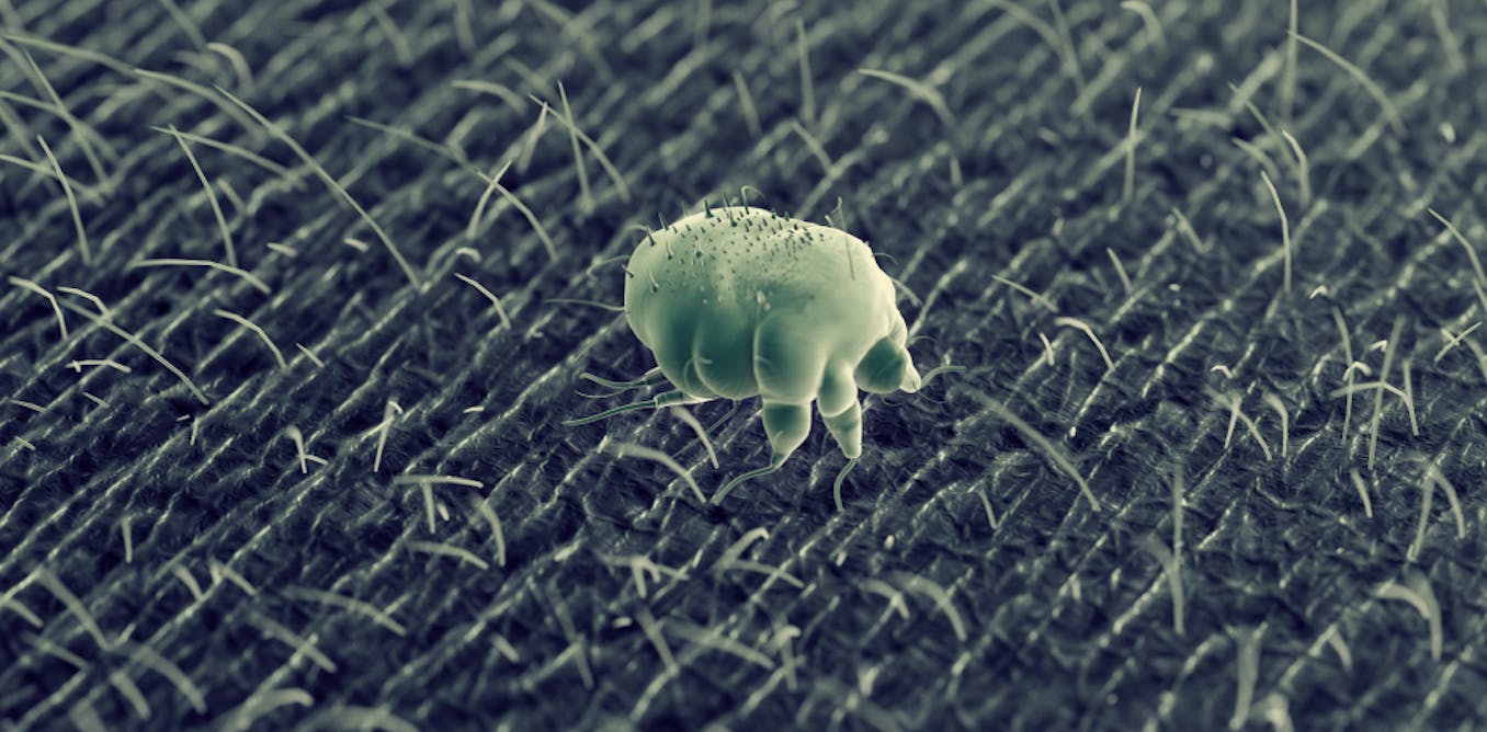 Scabies outbreak in UK and Europe – what you need to know