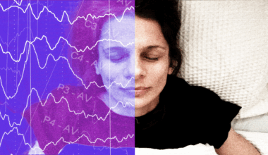 I snore - but didn’t know I stop breathing 10 times an hour in my sleep