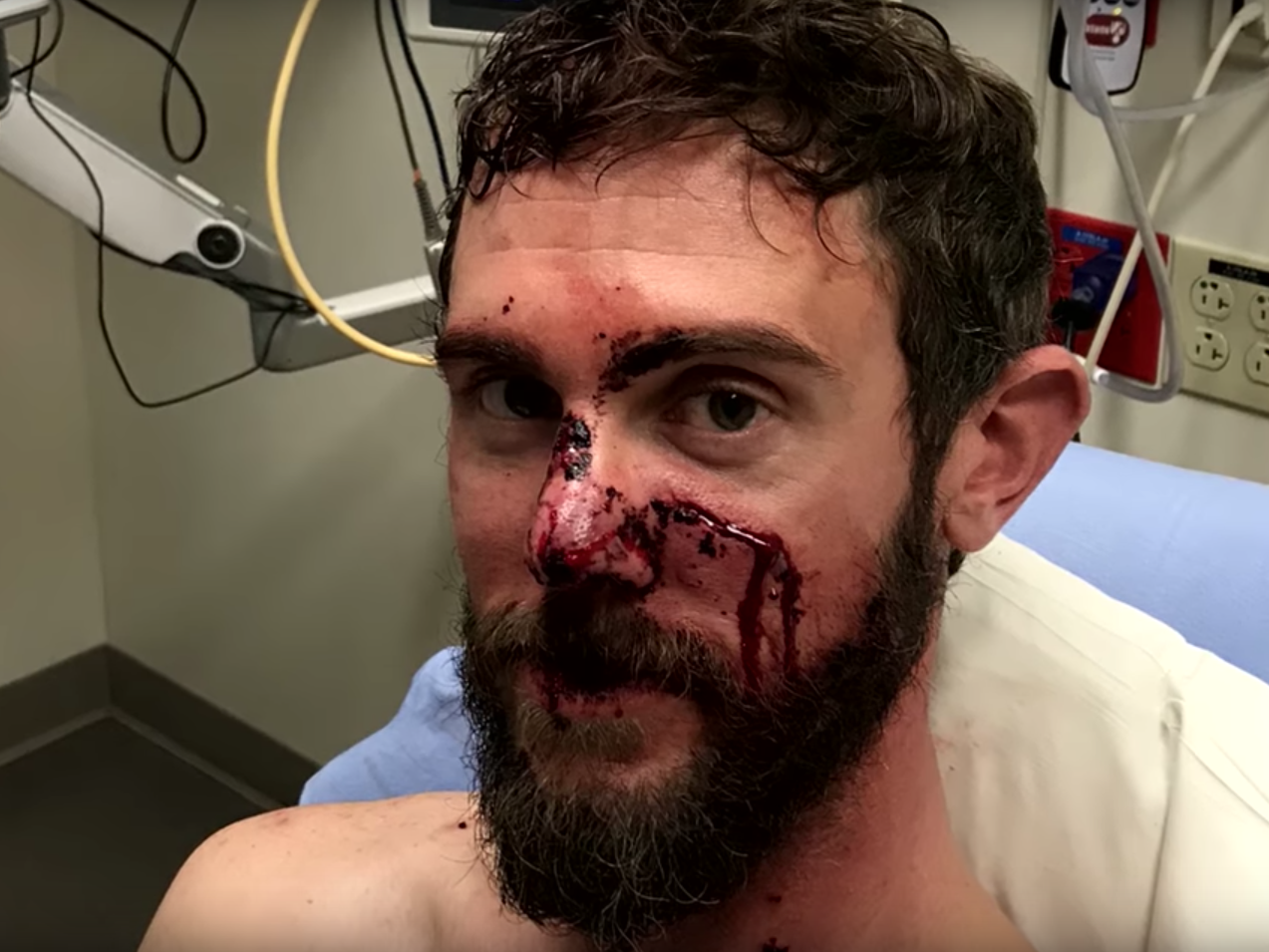 Travis Kauffman survived an attack by a mountain lion after wrestling the animal and eventually suffocating it with his foot on its throat.