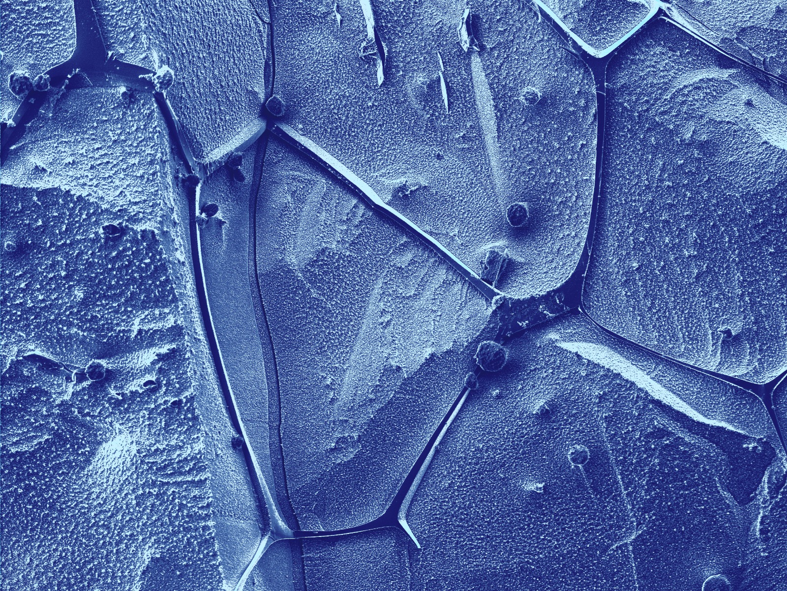 Pseudo-colored electron microscopy image of eutectic ice with a textured surface and defined boundaries between areas.