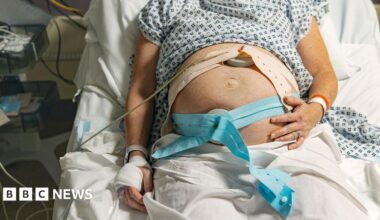Stock photo shows a pregnant woman lying on a hospital bed hooked up to care machines ahead of giving birth.