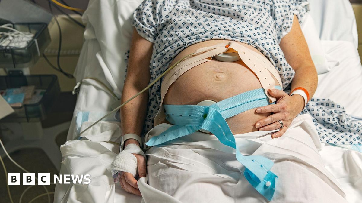 Stock photo shows a pregnant woman lying on a hospital bed hooked up to care machines ahead of giving birth.