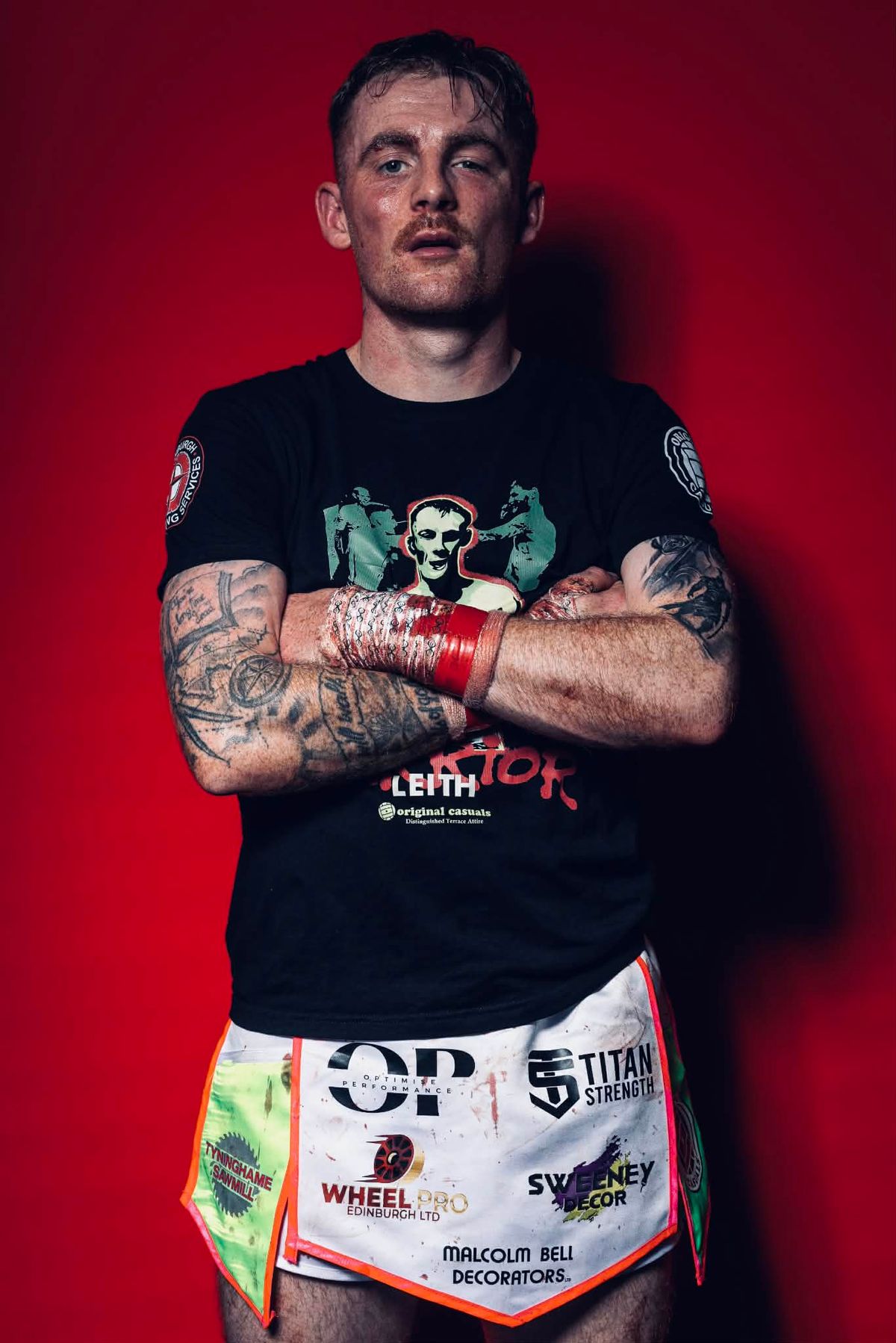 Lewis has suffered broken hands, cracked ribs and deep cuts during his time in the ring. 