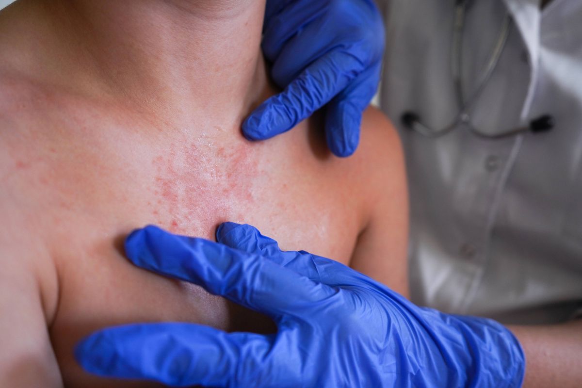 A boy with a red rash is being checked by the physician.