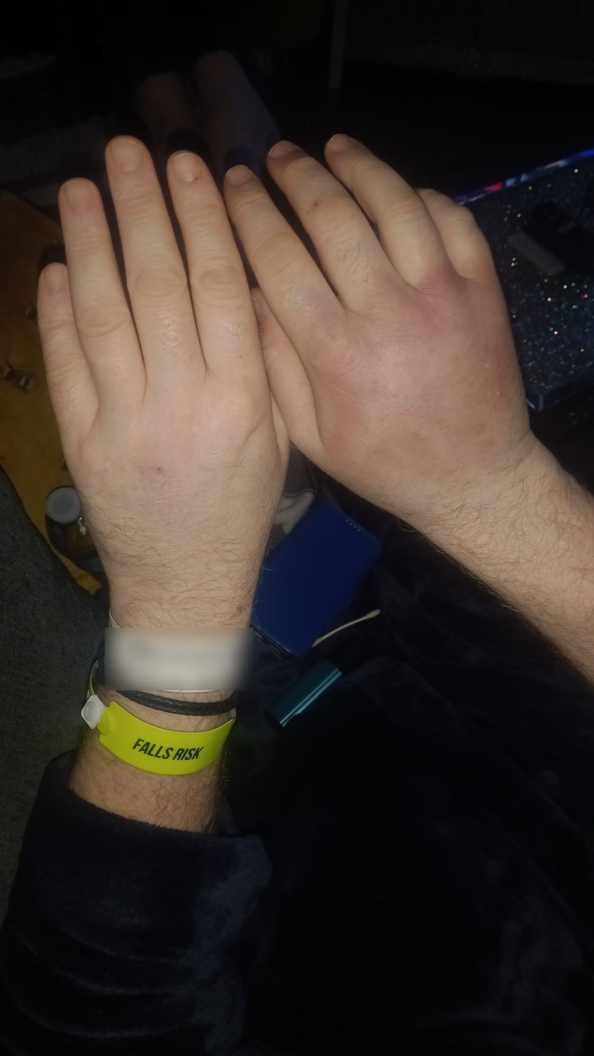 Christopher Birch's hand after a fall