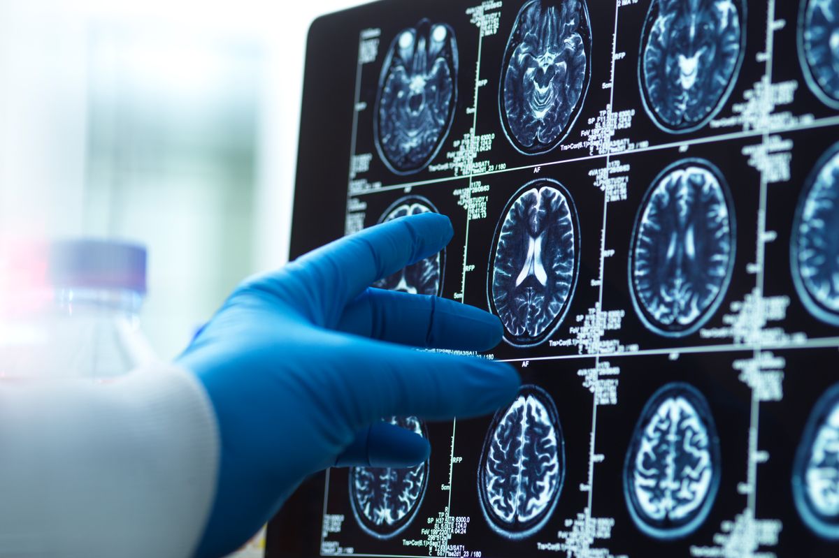 A scientist assessing a brain scan