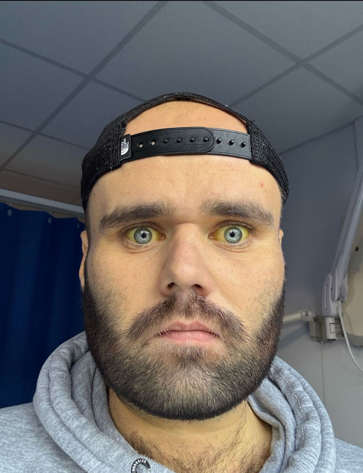 Sean was told he looked like a Simpsons character (Kennedy News and Media)