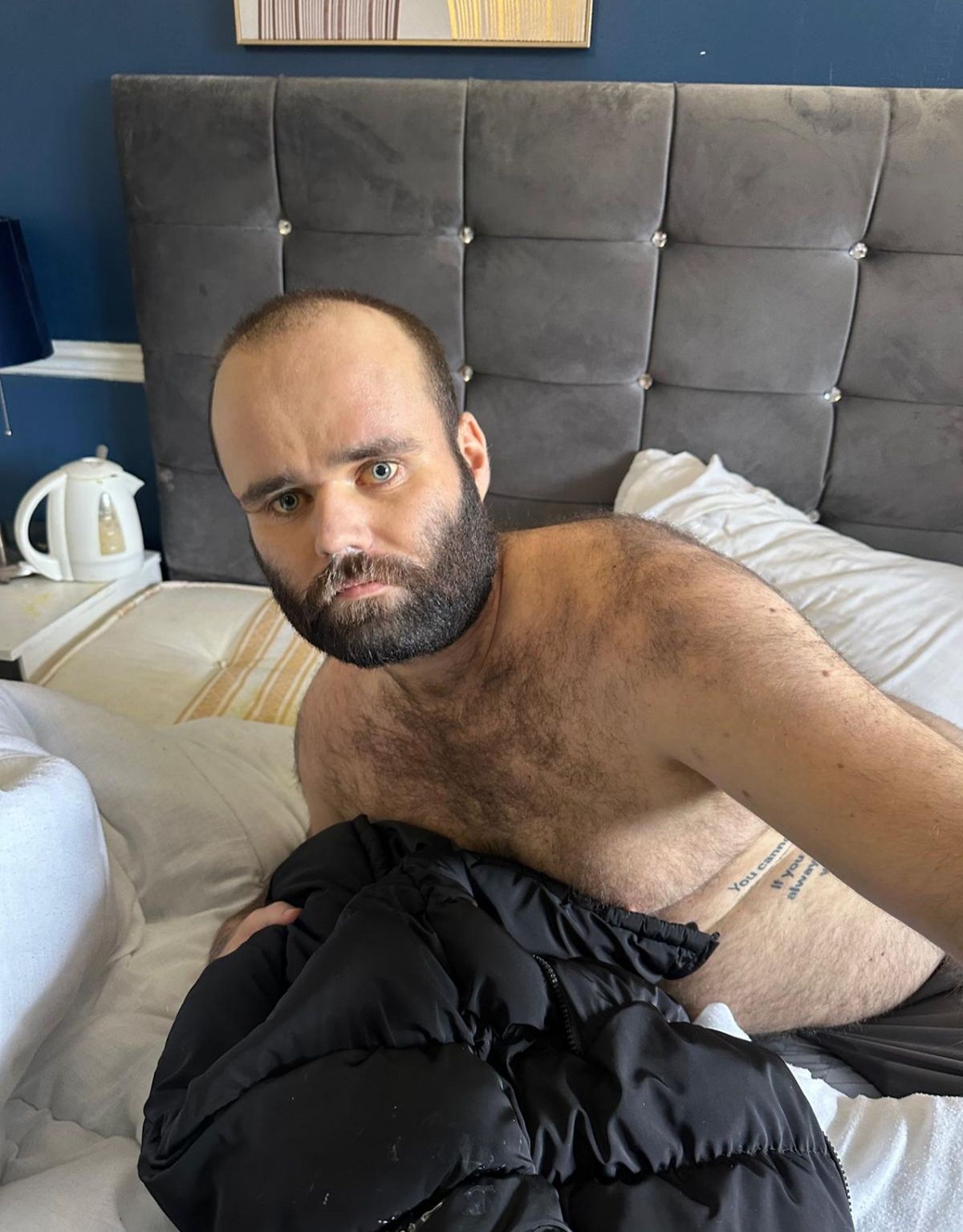 Sean has hepatitis (Kennedy News and Media)