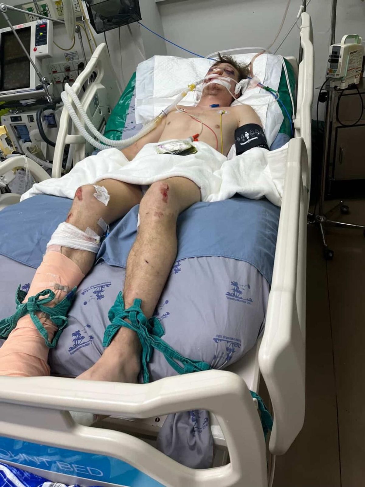 Zak has been left with multiple injuries