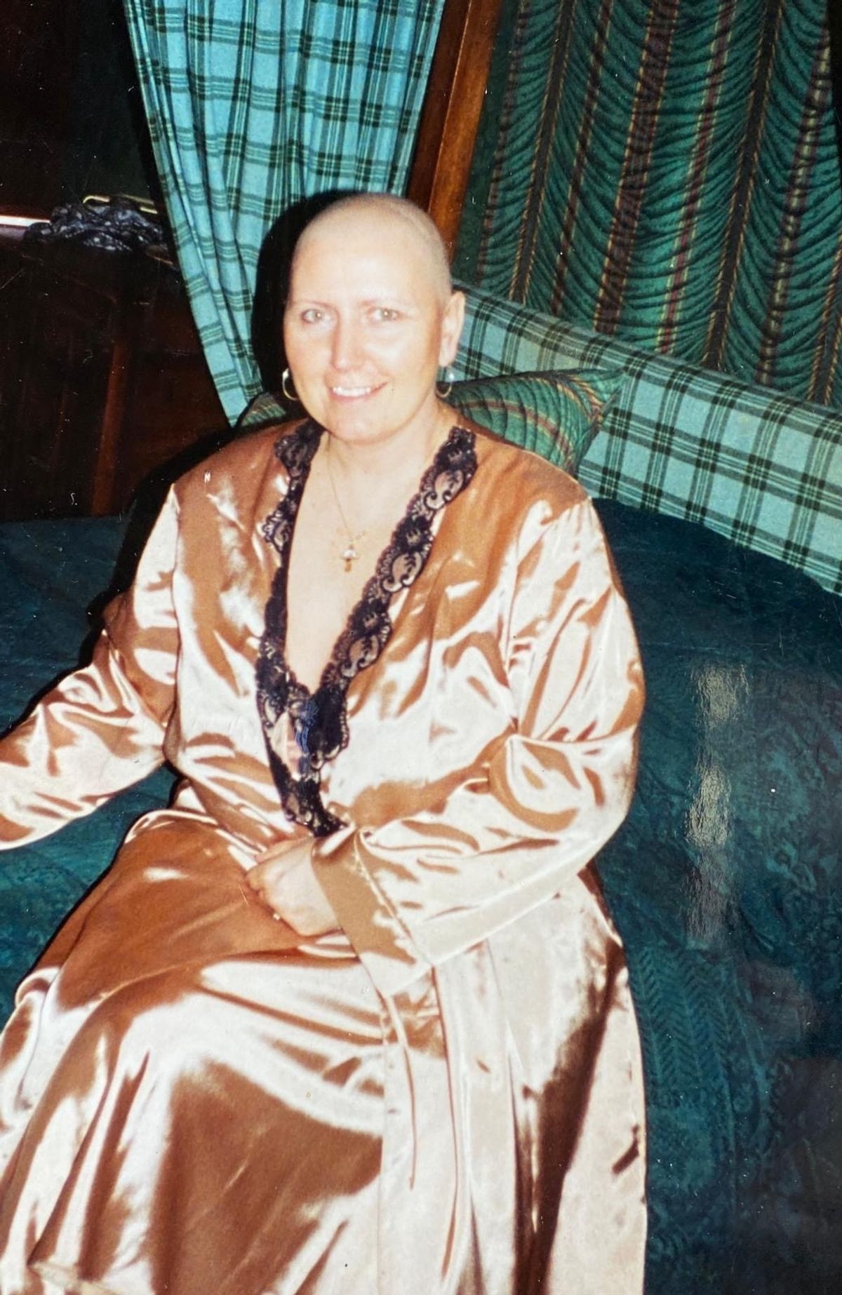 Deborah after losing her hair to chemo